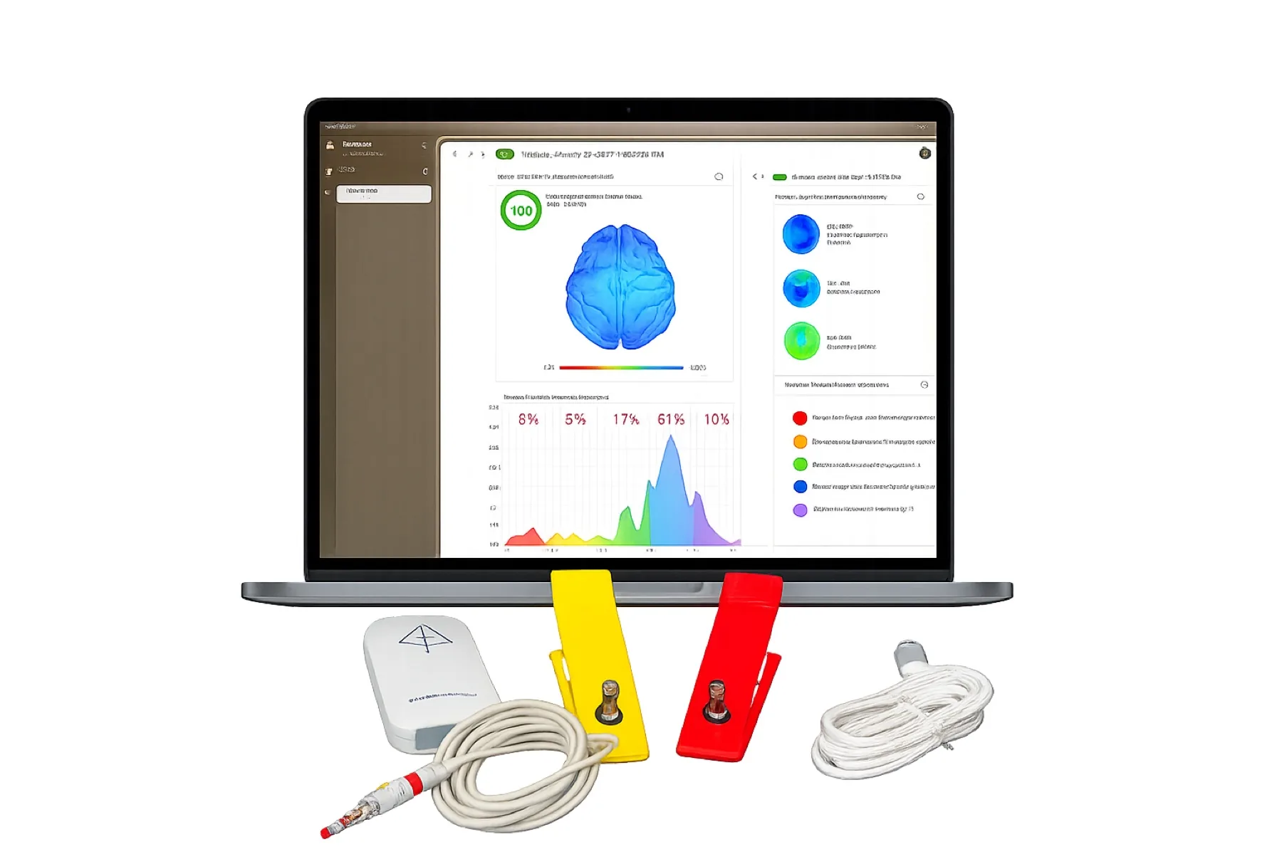 Bio Matrix Scan software displayed with the white interface device, red and yellow hand electrodes, and connection cable